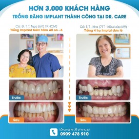 Đội ngũ bác sĩ nha khoa Dr. Care