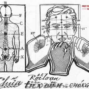 Cách chữa rối loạn tiền đình bằng diện chẩn